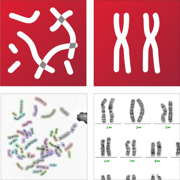 MetaSystems Announces Grant of US Patent for AI based Chromosome Analysis MetaSystems Announces Grant of US Patent for AI based Chromosome Analysis