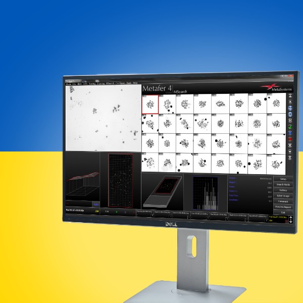 MetaSystems and Märzhäuser Wetzlar donate state-of-the-art medical equipment to Ukrainian children's clinic MetaSystems and Märzhäuser Wetzlar donate state-of-the-art medical equipment to Ukrainian children's clinic